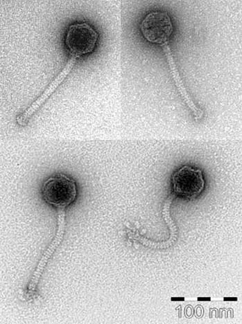 Elektronenmikroskopische Aufnahmen von thermo-stabilen Bakteriophagen