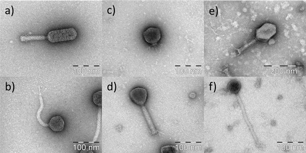 Elektronenmikroskopische Bilder ausgewählter Phagen 