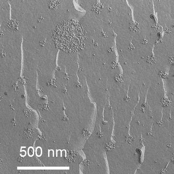 Mikroskopische Aufnahme eines Casein-Micellen-Retentats