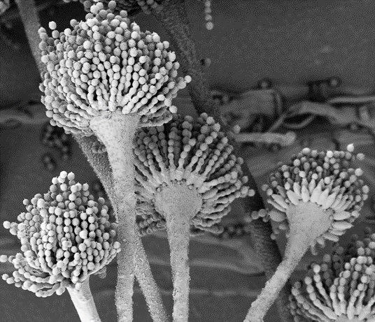 Mikroaufnahme Aflatoxinbildender Pilz