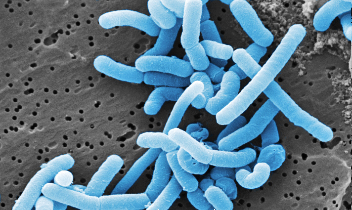 REM-Aufnahme Lactobacillus 