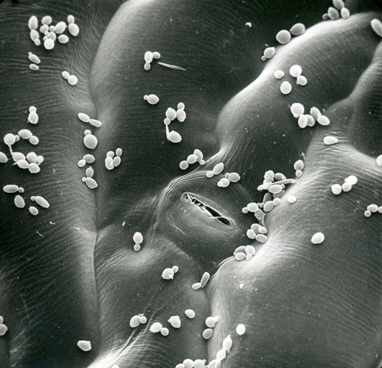 Rasterelektronenmikroskopische Aufnahme eines Salatblattes mit anhaftenden Bakterien
