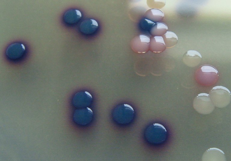 Bacterial isolates E. coli (blue to purple), Salmonella Enteritidis (white) and Klebsiella oxytoca (pink) from packaged mixed salad