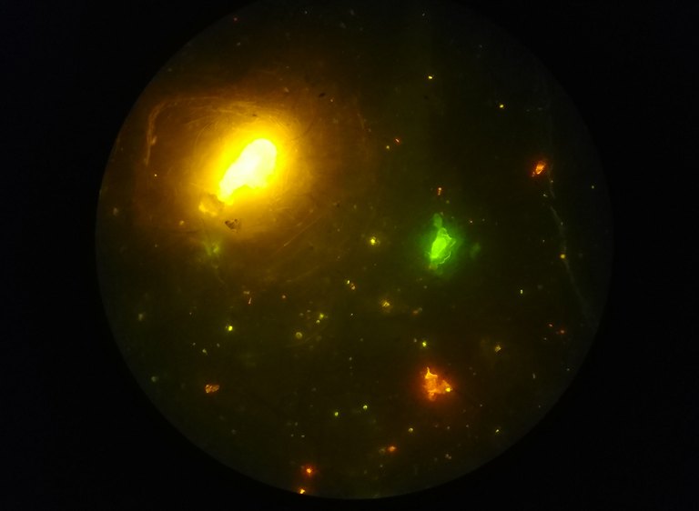 Blick durchs Mikroskop: Dunkele Fläche mit leuchtenden gelben, grünen und orangen Partikeln